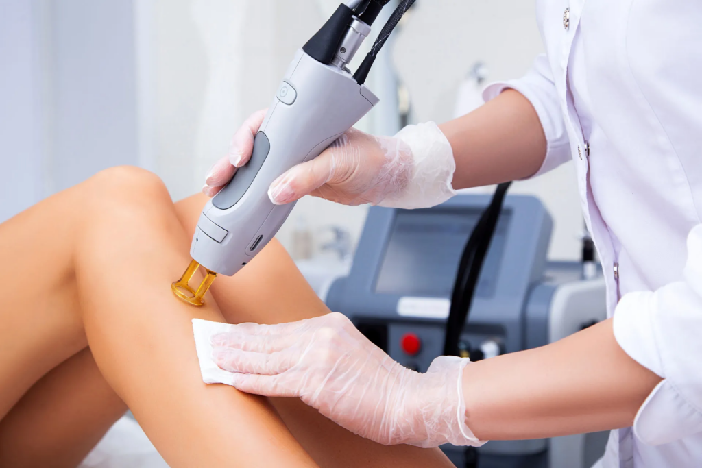 Best Laser Hair Removal Boston