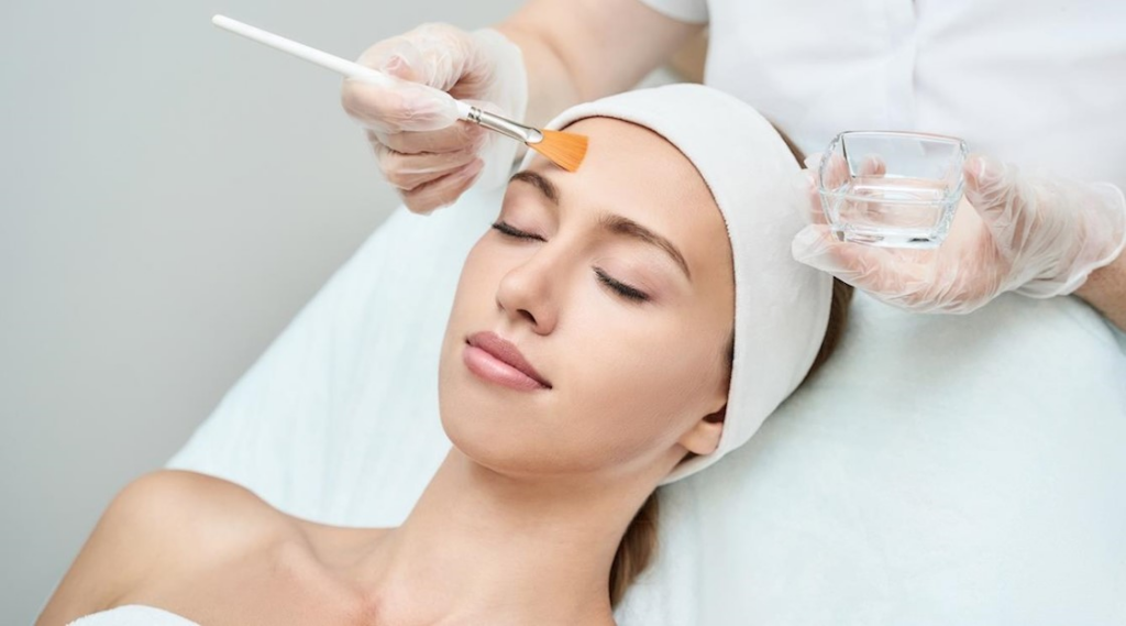 Is Facial Chemical Peel